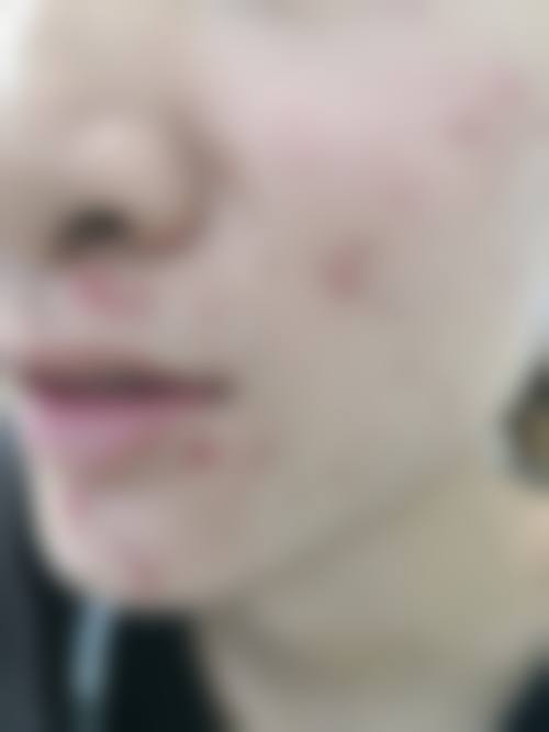 清远清城韩美医疗美容门诊正规吗