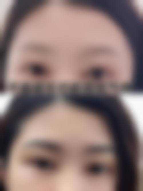 石家庄雍禾植发医疗美容诊所怎么样,价格表