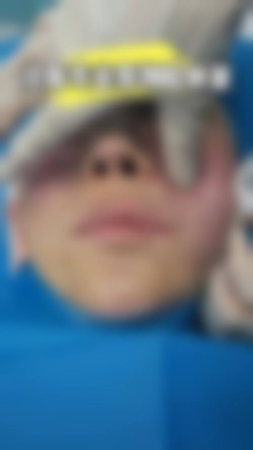 石家庄彤颜医疗美容诊所更擅长什么手术