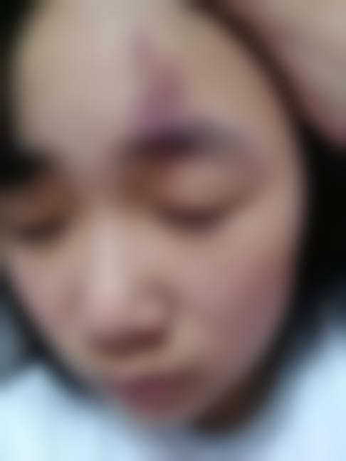 厦门欧韵整形医院医生简介:专精团队保护手术质量