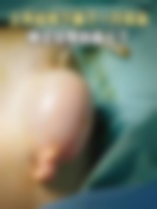 余姚蓓俪莎医疗美容诊所怎么样,更擅长什么手术