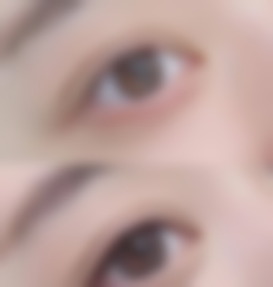 日照市人民医院美容外科怎么样之真实患者口碑