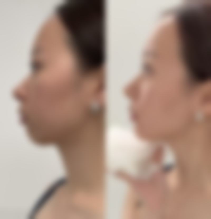 开封美特医疗美容诊所价格表