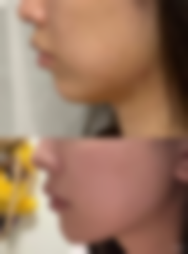 厦门欧韵整形医院地址及乘车路线:交通便利就诊方便