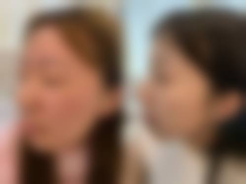 三、台安晨美整形医院口碑评价：高认可度的优质医美