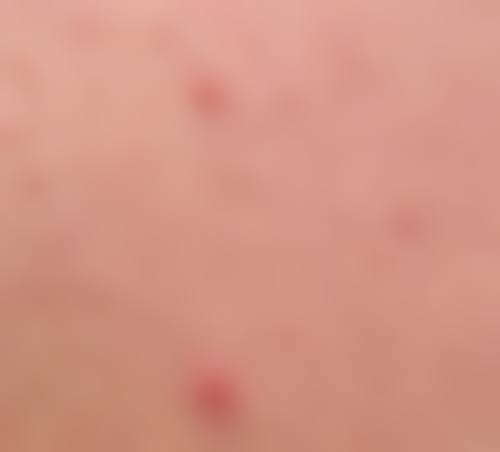 四、孝感现代俪人医院整形科项目特色如何