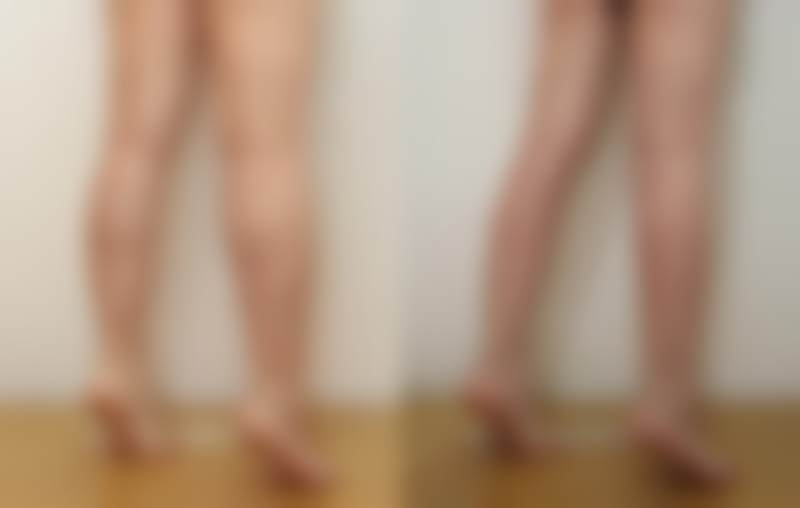 韩国Sage医院李敬秀16年经验的优势体现