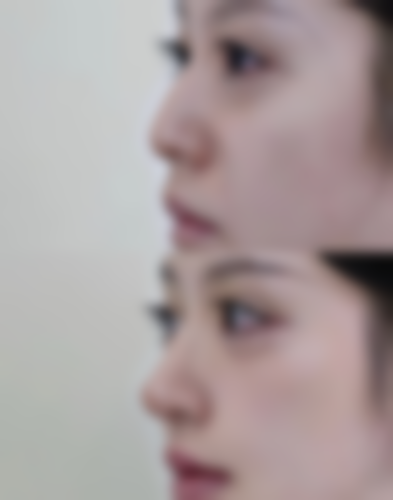 启东喜宝整形医院怎么样 - 项目特色