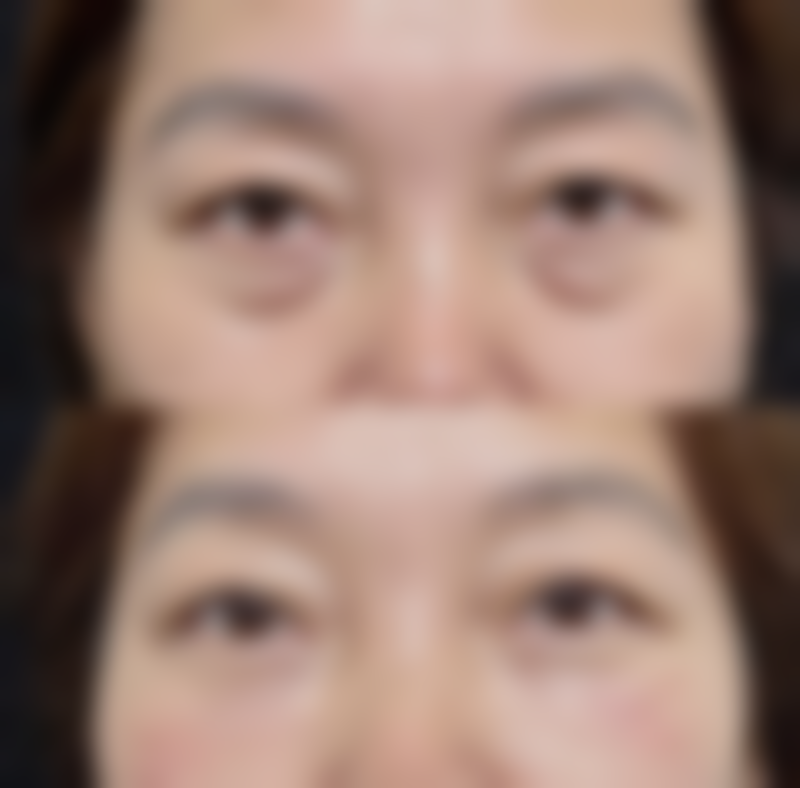 七、南京美尔嘉整形医院怎么样——口碑好不好?附真实患者口碑评价