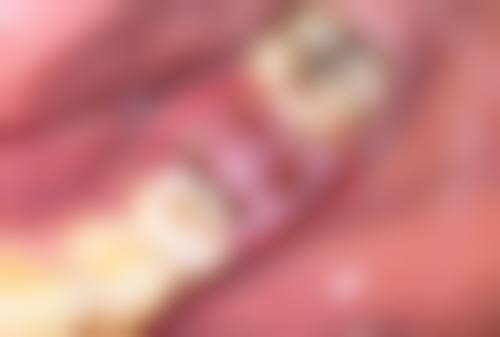 蒸汽眼罩热敷原理与消除眼袋的关联：三大魔法揭秘