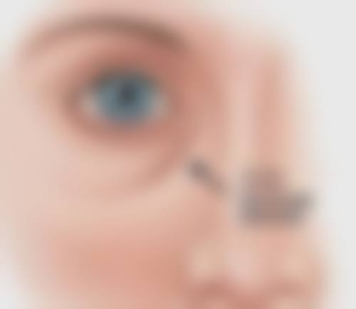 哺乳期做阴道紧缩术的成功几率剖析