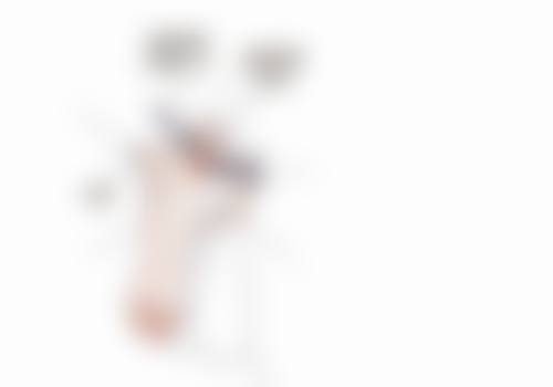 假体隆胸的成效能保持多久之假体质量是关键