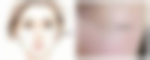 促进割双眼皮14天消肿的方法——医疗与居家结合