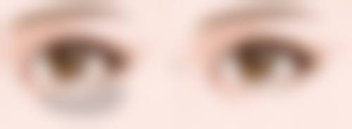 做完线提升三个月后做面部吸脂合适吗？