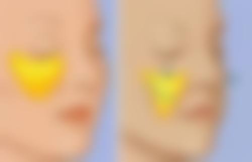 如何消掉熬夜的眼袋，冷敷+眼霜按摩双管齐下，7天告别泡泡眼