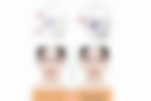 日常预防助你和早上起来眼睛浮肿眼袋大说拜拜