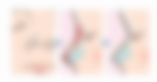 咸阳市彩虹医院整形美容科项目特色