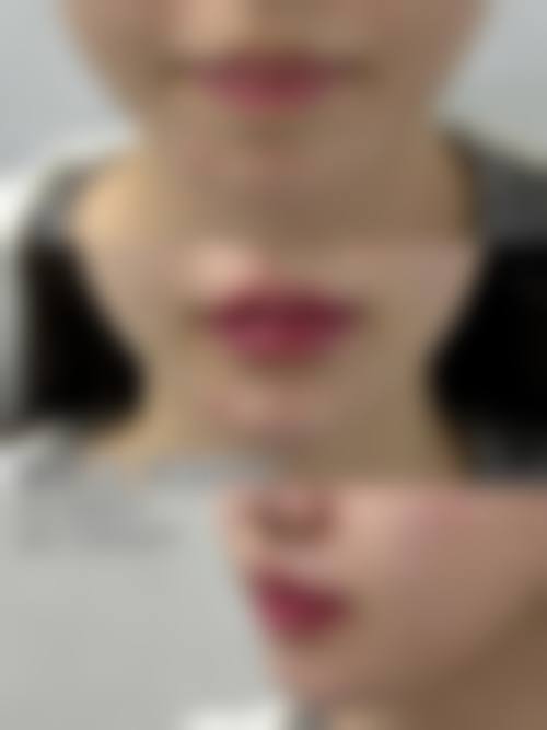 厦门菲思美科医疗美容资质情况