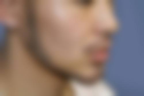 杭州星妍又丽医疗美容门诊部价格表