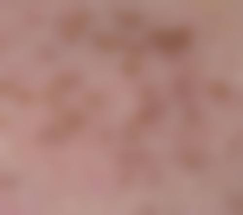 四川省泸州医学校附属医院怎么样,口碑评价如何?