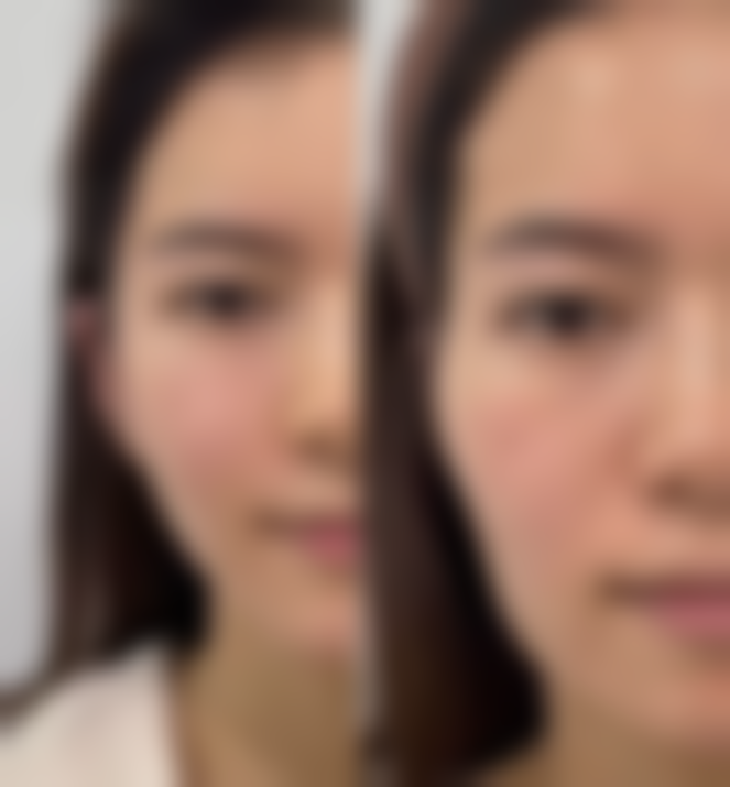 长期的下眼袋怎么去除——作息调整，规律生活保护眼部健康