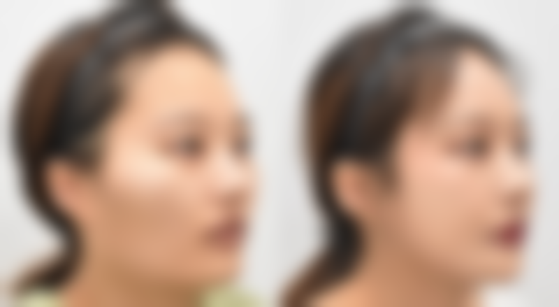 高海峰医生简介做手术价格