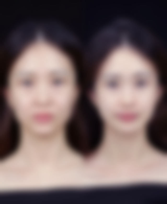 如何消掉熬夜的眼袋：双管齐下的 7 天计划——科学规划，告别眼袋