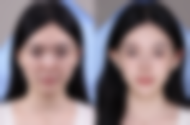 什么时候隆胸比较好？18岁后春秋季最佳，产后6个月恢复更稳妥