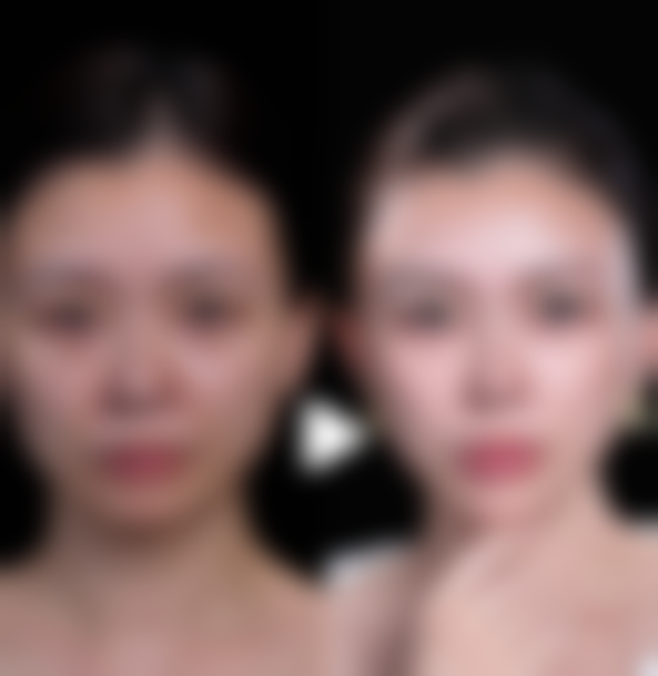 广州汝墨璇整形医院价格表怎么样