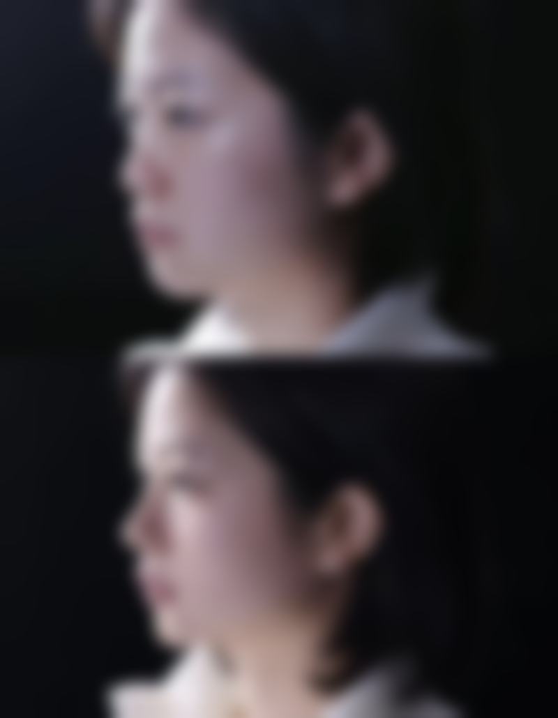 许昌正美韶华医疗整形韦婷联系方式——许昌市艺星医疗美容门诊