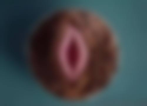 疤痕增生疙瘩用什么祛疤膏？医用级硅酮凝胶+积雪草精华双效修护，3个月平复凸起淡化色素