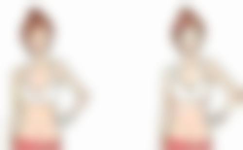 硅胶假体隆胸可以保存多久之术后护理秘籍