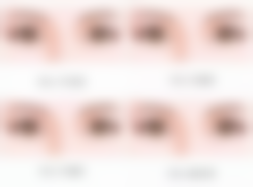 眼皮厚适合的双眼皮类型之新月型双眼皮:温柔优雅的折中之选