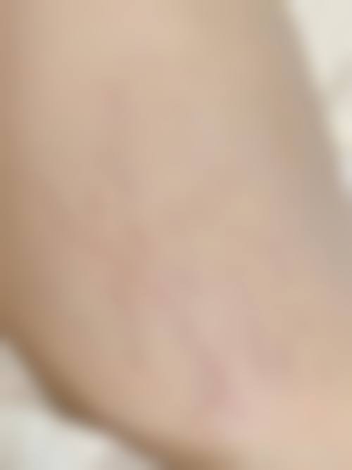 南宁优妍皮肤医疗美容医院怎么样，口碑评价如何？