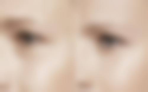 武汉斯启诺医疗美容门诊部王伟民之精细注射艺术