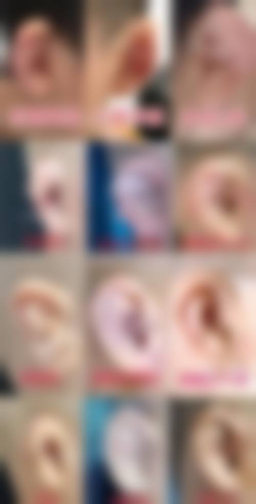 韩国NU整形外科怎么样?是否正规