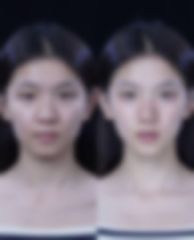 新疆医学会伊丽医疗整形美容门诊部更擅长什么