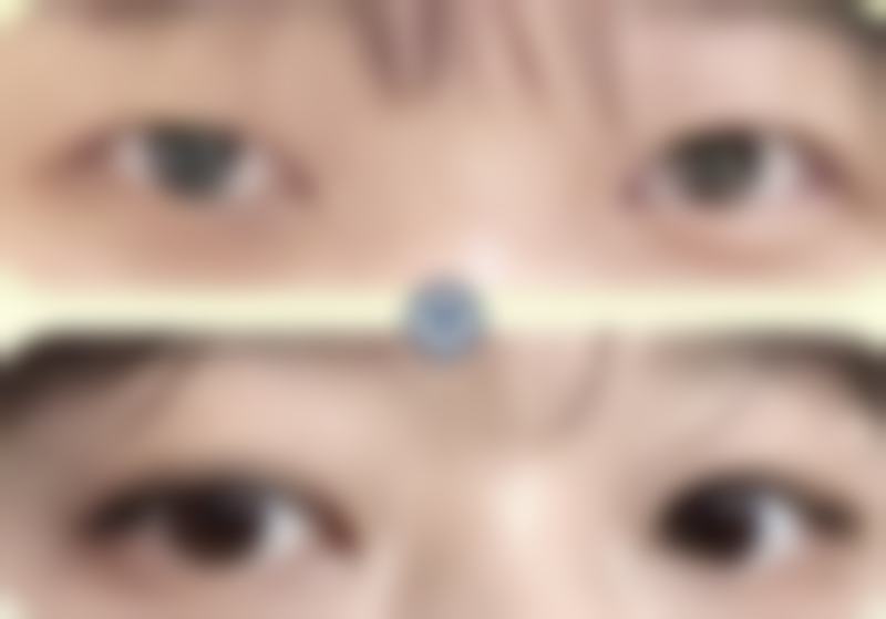 周瑞春医生简介做手术价格