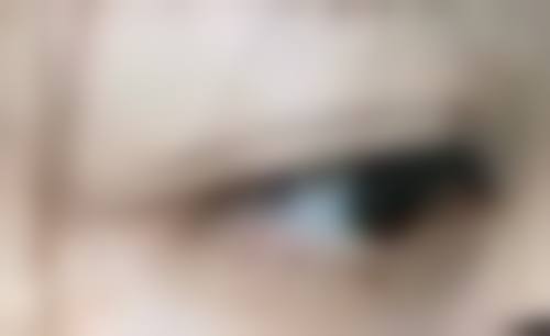 隆胸脂肪填充能维持多久之脂肪存活奥秘