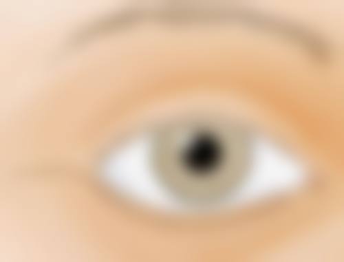 做了阴道紧缩术：不同手术方式决定不同修复时间