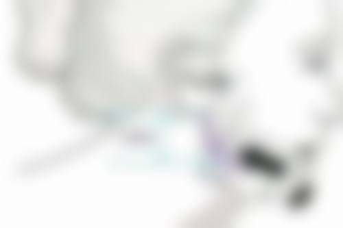 隆鼻后多久才能修复到至佳形态:成效持久性的维持方法