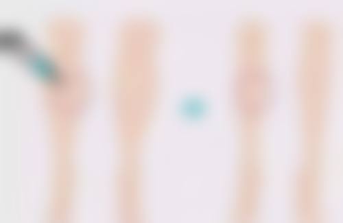 隆鼻后多久才能恢复到最佳形态，3-6个月自然定型，术后护理关键在这三点！