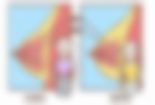 三等甲医院 vs 私立医院割双眼皮多少天可以出门:修复建议的差异