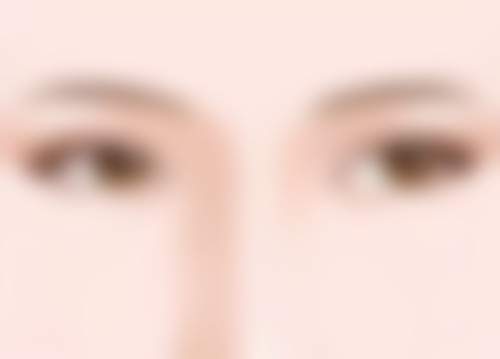 割双眼皮多少天可以出门，北京上海三甲医院医生建议7-10天恢复期