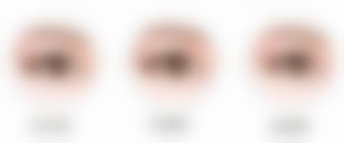 眼部按摩仪对不同类型眼袋的作用剖析