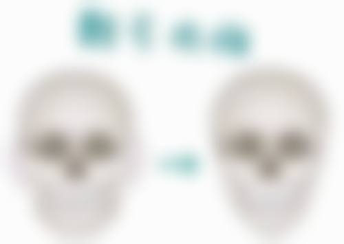 隆胸脂肪填充能维持多久之个人体质密码