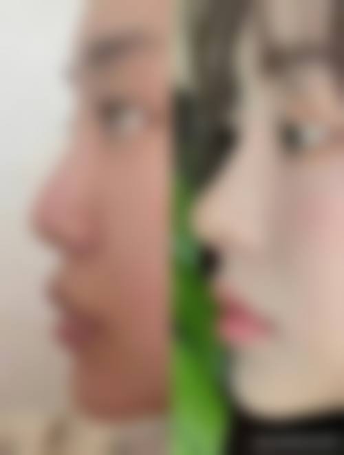 封月红医生简介做手术价格