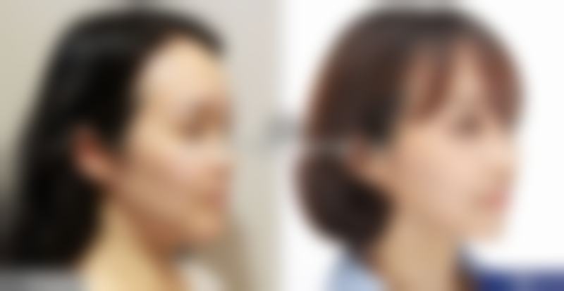 唐山市人民医院烧伤整形科项目特色