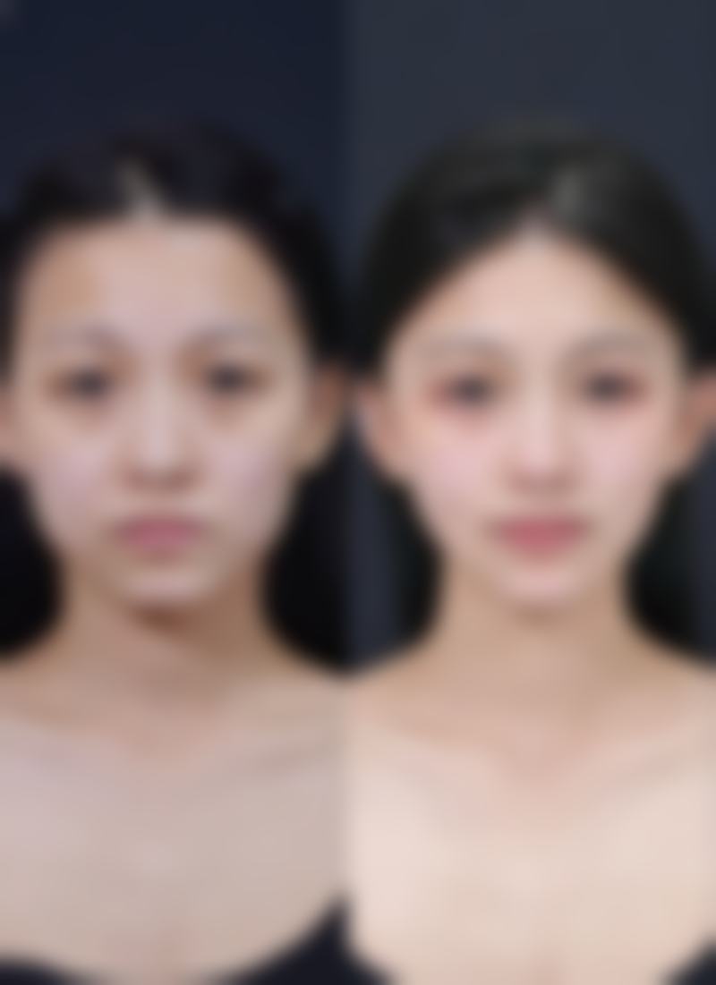 美皮护vs其他祛疤产品对比:优势明显