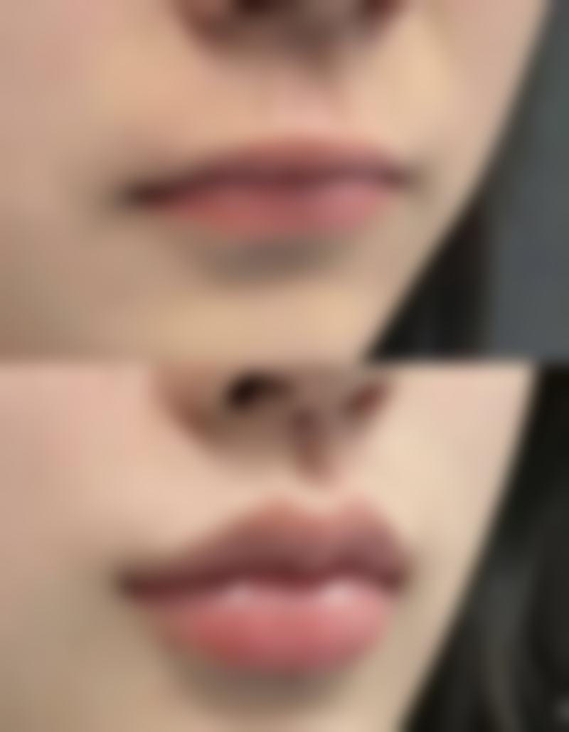 李金凤医生简介做手术价格：不同科室的大致参考